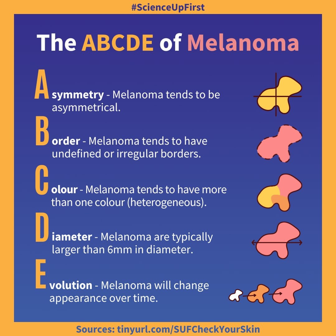 The ABCDE of Melanoma